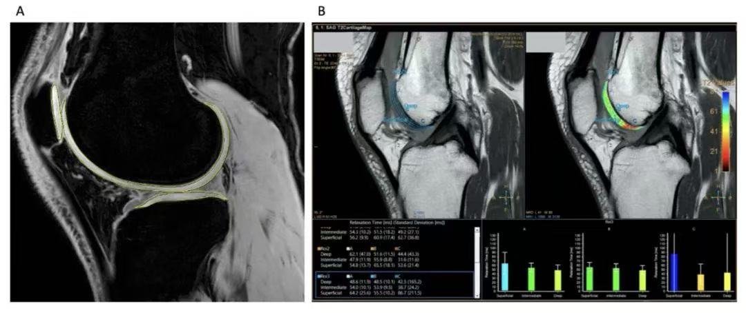 Case 1 Comparison Chart